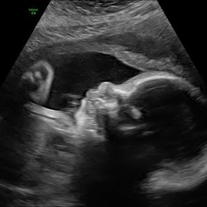 Meet your Posher, Kat